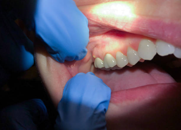 Best Emergency Dental Services for Seniors in Colbert, OK